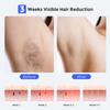 LUBEX Smart Permanent IPL Laser Hair Removal for Woman and Men, Painless Sapphire Ice-Cooling, Alternative to Salon, Bikini Shaver, Facial Epilator for Armpits Back Legs Arms Face Bikini Glow 6 A+ view 4