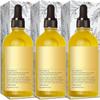 Gaukomzs 3PCS Natural and Rosemary Oil for Hair Growth, Dry Damaged and Thin Hair view 1