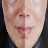 Vitality Precision Skin Retinol Peel Pads .5%- 3 month supply view 4