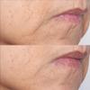 Cold Plasma Plus+ The Intensive Gel Mask, 2 fl. oz. view 4