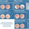 Blackhead Remover Pimple Popper Tool Kit, Blackhead Extractor Tool,11PCS Professional Pimple Comedone Extractor Tool for Blackheads, Acne, Whitehead,Zit Removing on Nose Face view 3