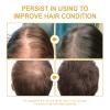 180 ML EELHOE Hair Growth Oil, Natural Rosemary Hair Growth Oil for Dry Damaged Hair and Growth Thin Hair. (3Pcs) view 3