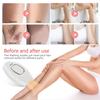 NATRSYM Hair Removal Device for Women and Men, IPL Laser Hair Removal Device with 5 Energy Levels, for Face, Arms, Legs, Bikini Line, Underarms, and Body, White view 4