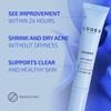 Codex Labs Shaant Spot Hero  Sulfur & Green Tea Gel for Blemish-Prone Skin | Fast-Drying Formula for Clear-Looking Skin | 0.5oz view 2