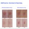Codex Labs Shaant Spot Hero  Sulfur & Green Tea Gel for Blemish-Prone Skin | Fast-Drying Formula for Clear-Looking Skin | 0.5oz view 4