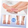 NOLITOY Dead Skin Removal Foot File Remover Gel for Feet Tools Stone Rasp Random Color view 2