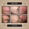 Crafted Beard Growth Kit - Grow a Thicker, Fuller Beard - Complete 3-Month Set with Oils, Roller, and Vitamins (1 Month Kit) view 2