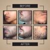 Crafted Beard Growth Kit - Grow a Thicker, Fuller Beard - Complete 3-Month Set with Oils, Roller, and Vitamins (1 Month Kit) view 3