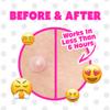 Pimple Patches for Face Original- Hydrocolloid Acne Patches for Blemishes & Breakouts and Absorbing Zits, Recover the Spot Quickly, Cover Spot from Dirt, Invisible Finished view 3