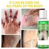 Dark Skin Exfoliating Oil, Extra Strong Green, For Hands, Feet and Whole Body, For At-Home Facial Chemical Exfoliation, 110ML/3.88Oz (1 PCS) view 4