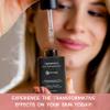 Turbinne Synergy Multi-Tasking Extra Strength Chemical Peel. Pure 5% Salicylic Acid + AHA. Best For Exfoliate, Rejuvenate, Rebuild Collagen & Acne Control 30 mL / 1 fl. oz view 2
