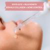 Turbinne Synergy Multi-Tasking Extra Strength Chemical Peel. Pure 5% Salicylic Acid + AHA. Best For Exfoliate, Rejuvenate, Rebuild Collagen & Acne Control 30 mL / 1 fl. oz view 3