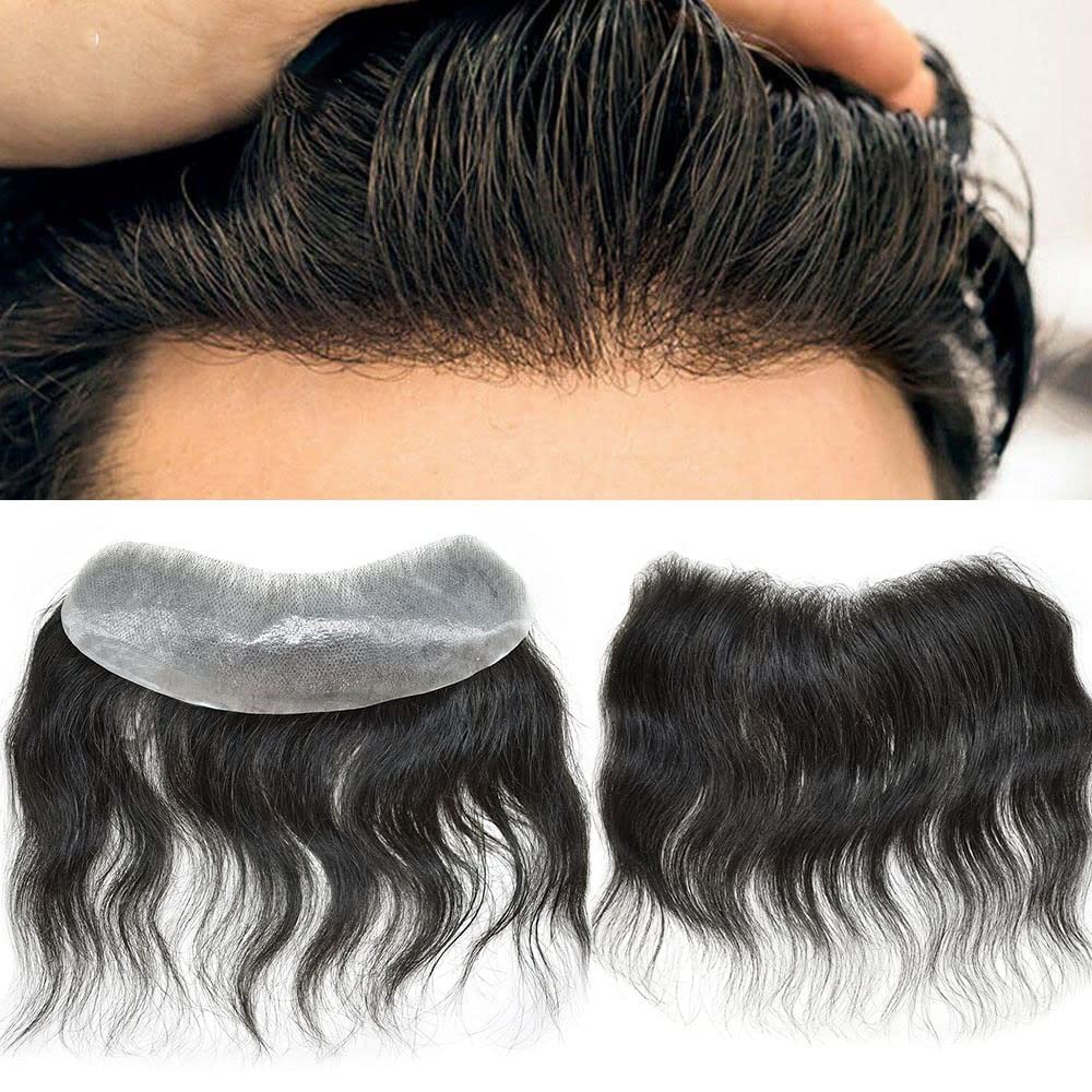 F M FACE MIRACLE NEW YORK Toupee For Men Forehead Natural Hairline Fronted Human Hair Replacement System Thin Skin Mens Toupee V-Looped PU Hairpiece (#2 Darkest Brown, 18x4)