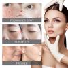 2Pcs Crema Para Manchas Oscuras En La Cara,Cremas Para Las Manchas de La Cara, Crema Aclaradora Para Piel Manchas En Cara view 3