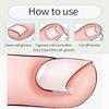 10 Pcs Ingrown Toenail Correction Strips Brace Kit, Ingrown Toenail Corrector Straightener Strips Recover Clips Toenails Thick Pedicure Tool Toenail Straightener Strip for Men Women Foot Care Tool Gr view 4
