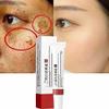 VoaiBekt Crema para Manchas Oscuras en La Cara, Cremas para Quitar Manchas de La Cara view 1