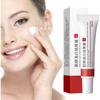 VoaiBekt Crema para Manchas Oscuras en La Cara, Cremas para Quitar Manchas de La Cara view 4