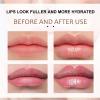 Mectix Lip Lightening Cream for Dark and Smoker Lips - Brightener Treatment for Pink Lips - Balm for Men and Women view 4