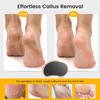BEZOX Nano-Glass Pumice Stone for Feet Dead Skin, Eco-Friendly Pedicure Foot File Callus Remover - Bamboo Handle view 3