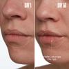 MALYS Cosmetics TOO-POUTY Clinically Proven Lip Plumping Mask - Helps Reduce The Appearance Of Fine Lines - Contains Adeplump to Plump The Look Of Lips view 3