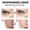 Spot Corrector for Face, Anti Aging Face Serum with Nicotinamide, Deep Hydrating and Moisturizing Instant Face Tightening Essence, Facial Serum Skin Care for Face Fine Lines for Women (3Pcs) view 4