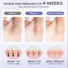 IPL Laser Hair Removal Device for Women & Men, Permanent Painless Hair Remover for Long-Lasting Results, Up to 85% Hair Reduction in 4 Weeks for Full Body & Face at Home view 3
