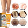 BEROZA 2PCS Crema Aclaradora, Crema Reparadora Para Manchas Oscuras 50ml, Adecuado para varias reas como cara, axilas, cuello, zona privada view 3