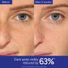 Caudalie Vinoperfect Brightening Dark Spot Serum Vitamin C Alternative - 62x More Effective than Vitamin C with Viniferine for a Visibly Brighter Even Complexion, 30 mL view 4