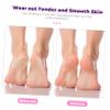 Ipetboom 12pcs Foot Care Exfoliator Tools Pumice Stones Callus Remover for Smooth Feet Ergonomic Design for Easy Use Portable Nail Care Kit for Home Salon view 4