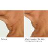NassifMD Deco-Lift Neck & Decollete Firming & Lifting Complex view 3