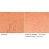 NassifMD Deco-Lift Neck & Decollete Firming & Lifting Complex view 4