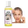 NinthAvenue Basics Extra Strong Peeling Oil, Peeling Oil for Dark Skin, Yellow Peeling Oil, Exfoliating Peeling Solution for Hand Feet, Chemical Peel for Face, 110ML / 3.88 OZ (1 PCS) view 1