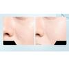 BeautyMAll 1 PC Caitang Light Mist Setting Spray, Long Lasting Moisturizing Oil Contorl Makeup Setting Spray Keep Your Makeup All Day Long, 120ml / 4.06 FL OZ (01 Moist For Dry Skin, 4.06 FL OZ) view 2
