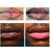 Rocet 2pcs Magic Lip Lighten Scrub Dark Black Lip Removal Exfoliation Pigmentation Fade Dull Pink Lip Balm Brighten Anti-Crack Moisturizing view 3