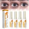 Turmeric Retinol Eye Cream Stick, Eye Balm Stick Hydrating for Dark Circles and Puffiness, Retinol Anti Aging Under Eye Cream, Reduces Fine Lines Eye Bags Eye Cream Stick for All Skin Types (4PCS) view 1