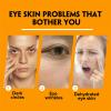 Turmeric Retinol Eye Cream Stick, Eye Balm Stick Hydrating for Dark Circles and Puffiness, Retinol Anti Aging Under Eye Cream, Reduces Fine Lines Eye Bags Eye Cream Stick for All Skin Types (4PCS) view 3