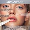 Cayes 2PCS Whitening Remove Dark Lip Balm Moisturizing Cream Hyaluronic Acid Exfoliating Dead Skin Lightening Pigment Care Beauty Health view 3