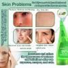JunKuJK 99% Purity Aloe Vera Gel,260ml - Hydrating Aloe Vera Gel for Face and Skin,No Sticky Moisturizing Aloe Gel A view 3