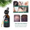 Tgideas Rosemary Batana Oil - Organic Hair Growth -for Scalp & Hair Strengthening - All Hair Types Treatment Oil - Eyebrow & Eyelash Nourishing view 3
