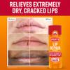 O'Keeffe's Lip Repair Lip Balm with Cherry & Vitamin E Oil - Stick (3 Pack) - Moisturizer for Extremely Cracked, Dry Lips view 2