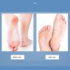 3-in-1 Foot File Callus Remover, Stainless Steel Foot Scrubber Foot Care Tool for Glossy Feet, Foot Sander for Home Spa Pedicure Use view 4