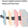 aiqiua Blackhead Remover, Pore Vacuum Cleaner, Whitehead Remover Tool with with 4 Replacement Head and 3 Level SuctionSafe, Effective, Painless, Portable and Easy to use view 3