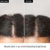 Love Ur Curls Exfoliating Scalp Scrub, Moisturizing, Gentle Build Up Removal for Curly Hair - with Peppermint Oil, for Alll Curl Types, 150mL view 4