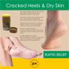 B4Nine Essentials Cracked Heel Repair Tea Tree Foot Cream Stick for Dry Skin Heel Moisturizer Balm Treatment. Made in Canada 2.5oz (1 Pack, Natural) view 2
