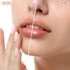 Facial Hair Remover for Women - as Seen on TV Painless Face Shaver - Electric Hair Removal Device for Face Lips Peach Fuzz with Light (White) view 3