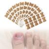 Ingrown Toenail Corrector Patch, 100 Pcs, No Glue & Breathable, 0.5"Wx0.7"L view 1