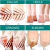 Honest Good Skin 40% Urea Hand and Foot Repair Cream view 2