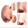 Generic 4 in 1 Blackhead Remover Machine Facial Pore Deep Cleansing (Black) view 2
