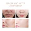 Bonseor Purifying Exfoliating Gel,Cream, Face And Body Exfoliating Scrub Gel for All Skin (2 PCS) view 3