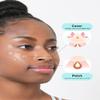 OLIVE YOUNG Care Plus Spot Patch | Hydrocolloid Acne Korean Spot Patch to Cover Zits, Pimples and Blemishes, for Troubled Skin and Face (Hydrocolloid, 30 Count (Pack of 2)) view 4